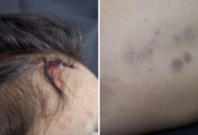 Vista da unidade de saúde em Aparecida de Goiânia.