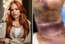 Dentista Valéria Ribeiro, indiciada por lesões gravíssimas em pacientes.