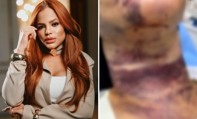 Dentista Valéria Ribeiro, indiciada por lesões gravíssimas em pacientes.