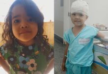Menina de 4 anos hospitalizada após ataque de pit bull em Goiânia.