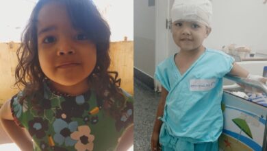 Menina de 4 anos hospitalizada após ataque de pit bull em Goiânia.