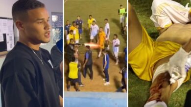 Goleiro Ramon Souza atingido por tiro de bala de borracha em campo de futebol.