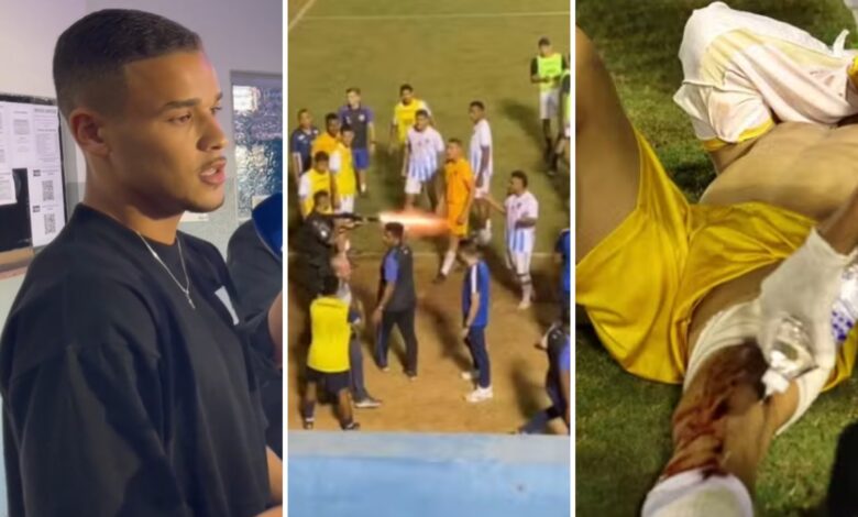 Goleiro Ramon Souza atingido por tiro de bala de borracha em campo de futebol.